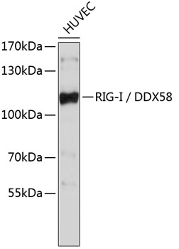 Western blot - RIG-I / DDX58 Polyclonal Antibody 