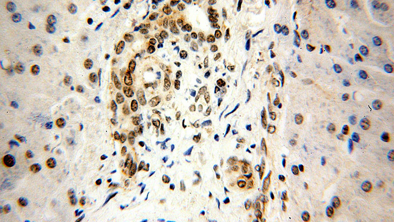 Immunohistochemical of paraffin-embedded human liver using Catalog No:111513(HNRNPU antibody) at dilution of 1:100 (under 40x lens)