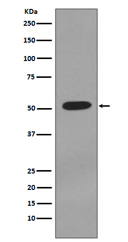 Western blot analysis of Cytokeratin 7 expression in T47 D cell lysate.