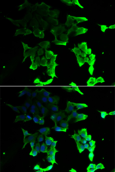 Immunofluorescence - TANK Polyclonal Antibody 