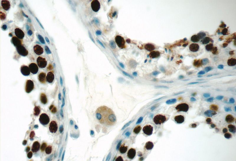 Immunohistochemistry of paraffin-embedded human testis tissue slide using Catalog No:117075(AUTS2 Antibody) at dilution of 1:50 (under 40x lens)