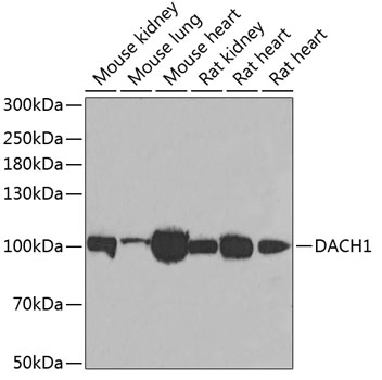 Western blot - DACH1 Polyclonal Antibody 