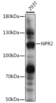 Western blot - NPR2 Polyclonal Antibody 