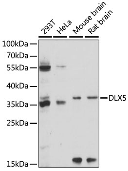 Western blot - DLX5 Polyclonal Antibody 