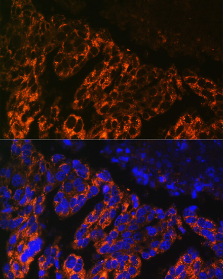 Immunofluorescence - SCNN1A Polyclonal Antibody 