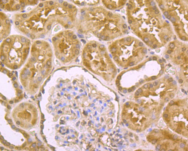 Fig5: Immunohistochemical analysis of paraffin-embedded human kidney tissue using anti-DLL4 antibody. Counter stained with hematoxylin.