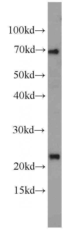 NIH/3T3 cells were subjected to SDS PAGE followed by western blot with Catalog No:114915(RPS7 antibody) at dilution of 1:600
