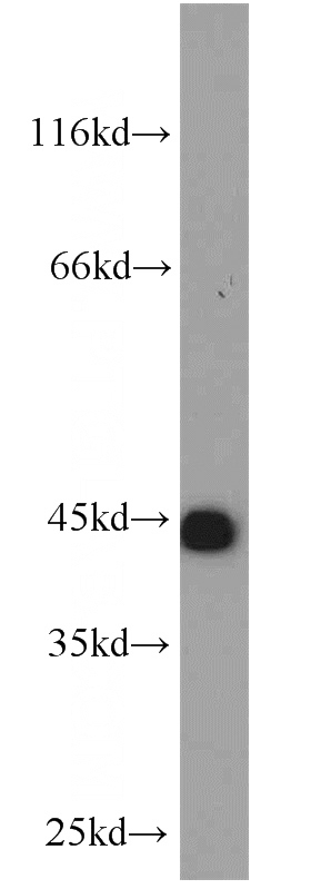 HeLa cells were subjected to SDS PAGE followed by western blot with Catalog No:112093(KLHL14-Specific antibody) at dilution of 1:1000