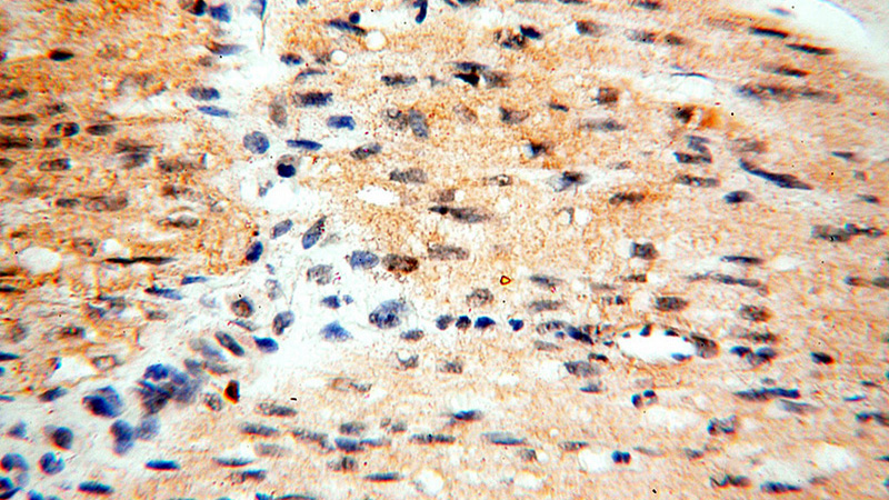 Immunohistochemical of paraffin-embedded human heart using Catalog No:115163(SGCG antibody) at dilution of 1:50 (under 40x lens)
