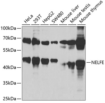 Western blot - NELFE Polyclonal Antibody 