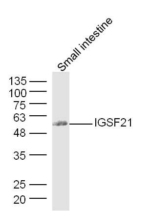 Fig1: Sample: Small intestine (Mouse) Lysate at 40 ug; Primary: Anti-FAM83F at 1/300 dilution; Secondary: IRDye800CW Goat Anti-Rabbit IgG at 1/20000 dilution; Predicted band size: 55 kD; Observed band size: 55 kD