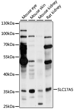 Western blot - SLC17A5 Polyclonal Antibody 