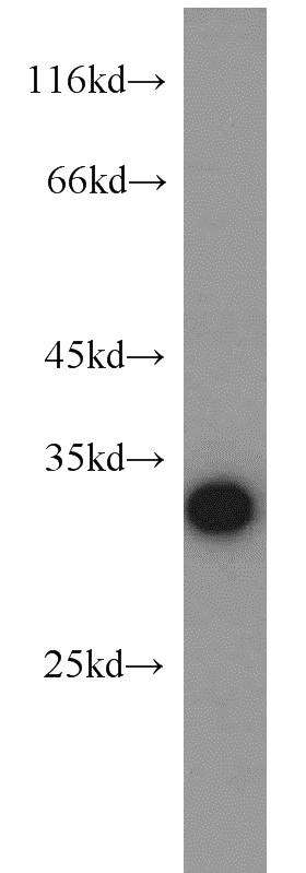 A375 cells were subjected to SDS PAGE followed by western blot with Catalog No:109724(CTHRC1 antibody) at dilution of 1:800