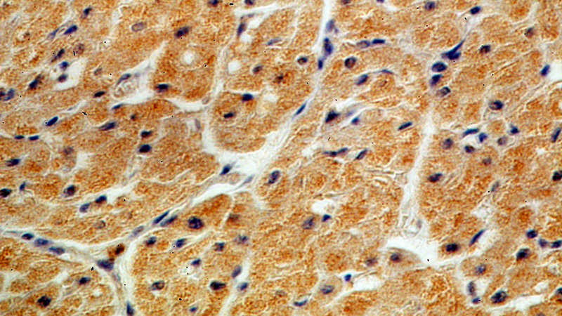 Immunohistochemical of paraffin-embedded human heart using Catalog No:113051(ND2 antibody) at dilution of 1:50 (under 40x lens)