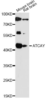 Western blot - ATCAY Polyclonal Antibody 