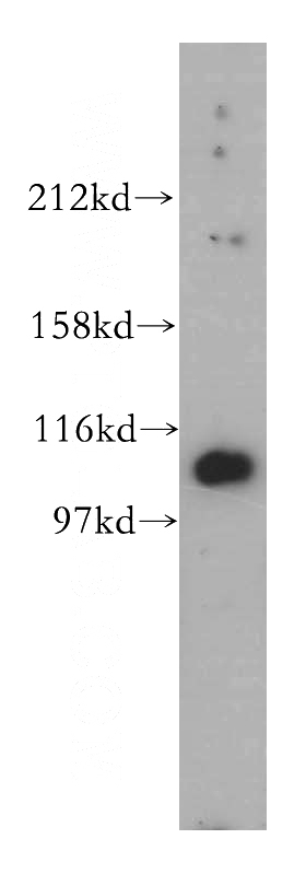 mouse testis tissue were subjected to SDS PAGE followed by western blot with Catalog No:112733(MORC1 antibody) at dilution of 1:500
