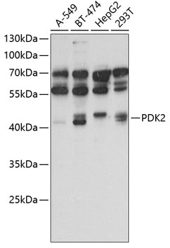 Western blot - PDK2 Polyclonal Antibody 