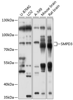 Western blot - SMPD3 Polyclonal Antibody 