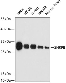 Western blot - SNRPB Polyclonal Antibody 