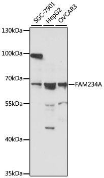 Western blot - FAM234A Polyclonal Antibody 