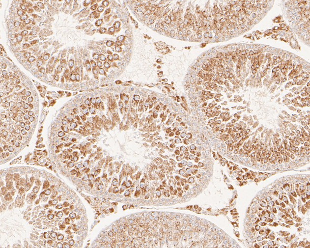 Fig2:; Immunohistochemical analysis of paraffin-embedded rat testis tissue using anti-FYCO1 antibody. The section was pre-treated using heat mediated antigen retrieval with Tris-EDTA buffer (pH 8.0-8.4) for 20 minutes.The tissues were blocked in 5% BSA for 30 minutes at room temperature, washed with ddH; 2; O and PBS, and then probed with the primary antibody ( 1/500) for 30 minutes at room temperature. The detection was performed using an HRP conjugated compact polymer system. DAB was used as the chromogen. Tissues were counterstained with hematoxylin and mounted with DPX.