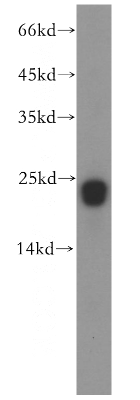 human brain tissue were subjected to SDS PAGE followed by western blot with Catalog No:114504(RAC1/2/3 antibody) at dilution of 1:1000