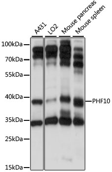 Western blot - PHF10 Polyclonal Antibody 
