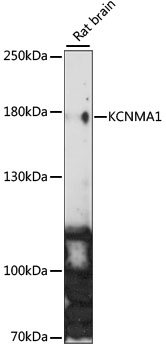 Western blot - KCNMA1 Polyclonal Antibody 