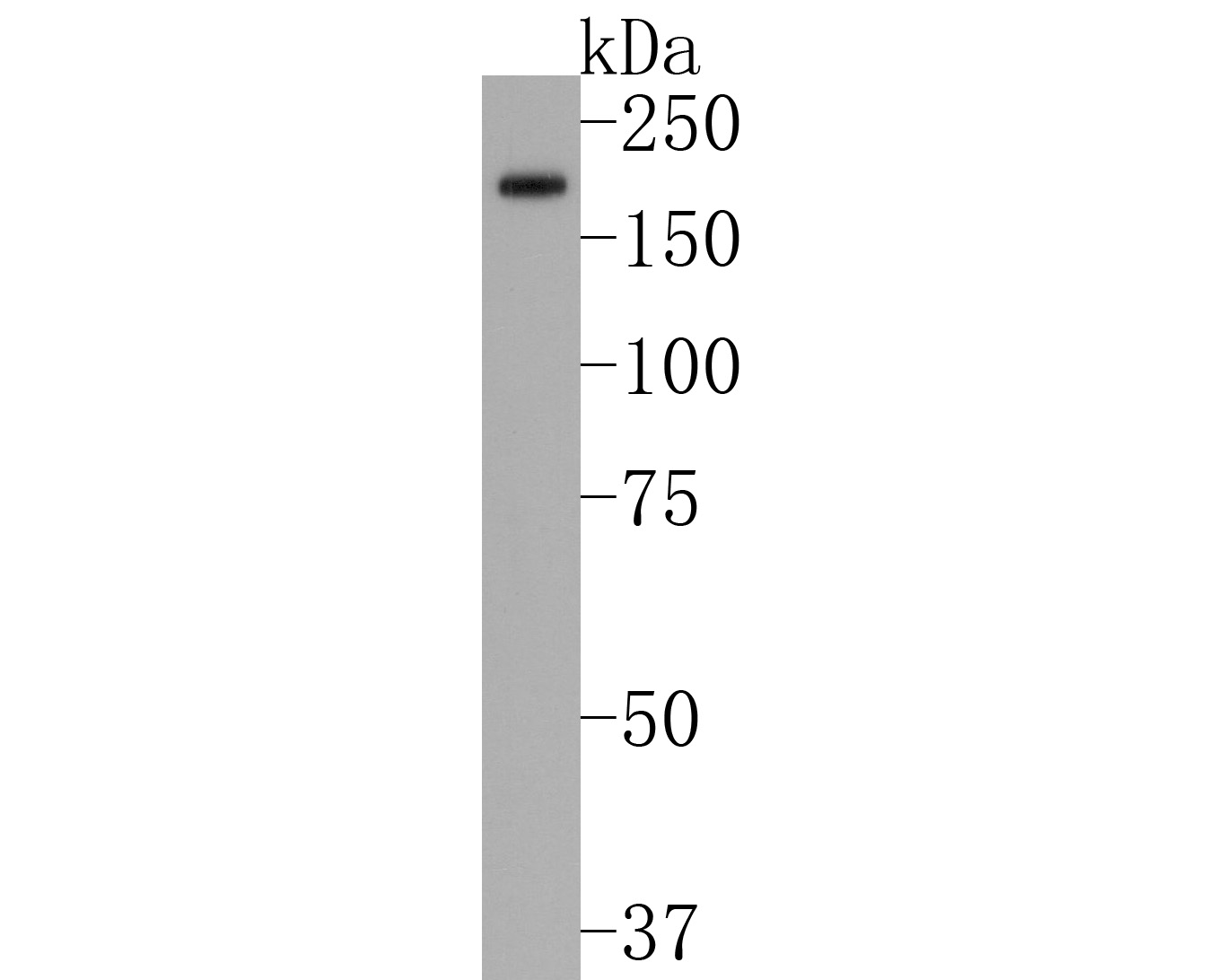 Fig1:; Western blot analysis of Factor H on human kidney tissue lysates. Proteins were transferred to a PVDF membrane and blocked with 5% BSA in PBS for 1 hour at room temperature. The primary antibody ( 1/500) was used in 5% BSA at room temperature for 2 hours. Goat Anti-Rabbit IgG - HRP Secondary Antibody (HA1001) at 1:200,000 dilution was used for 1 hour at room temperature.