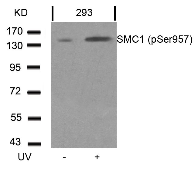 Western blot analysis of extracts from 293 cells untreated or treated with UV using SMC1 (Phospho-Ser957) Antibody .