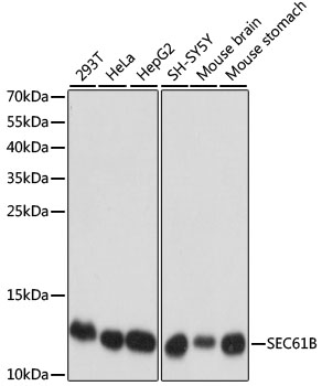 Western blot - SEC61B Polyclonal Antibody 