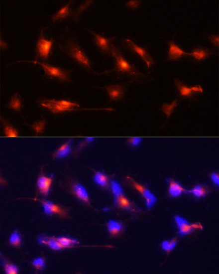 Immunofluorescence - Nestin Polyclonal Antibody 
