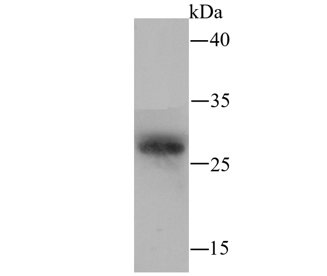 Fig2: Western blot analysis of PRTN3 on mouse marrow lysate using anti-PRTN3 antibody at 1/100 dilution.
