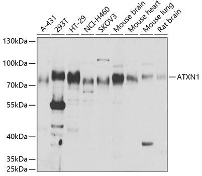 Western blot - ATXN1 Polyclonal Antibody 