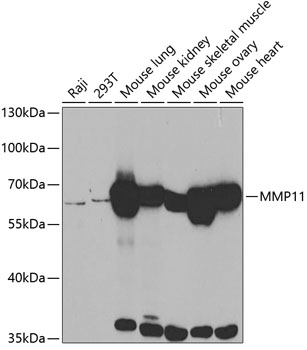 Western blot - MMP11 Polyclonal Antibody 