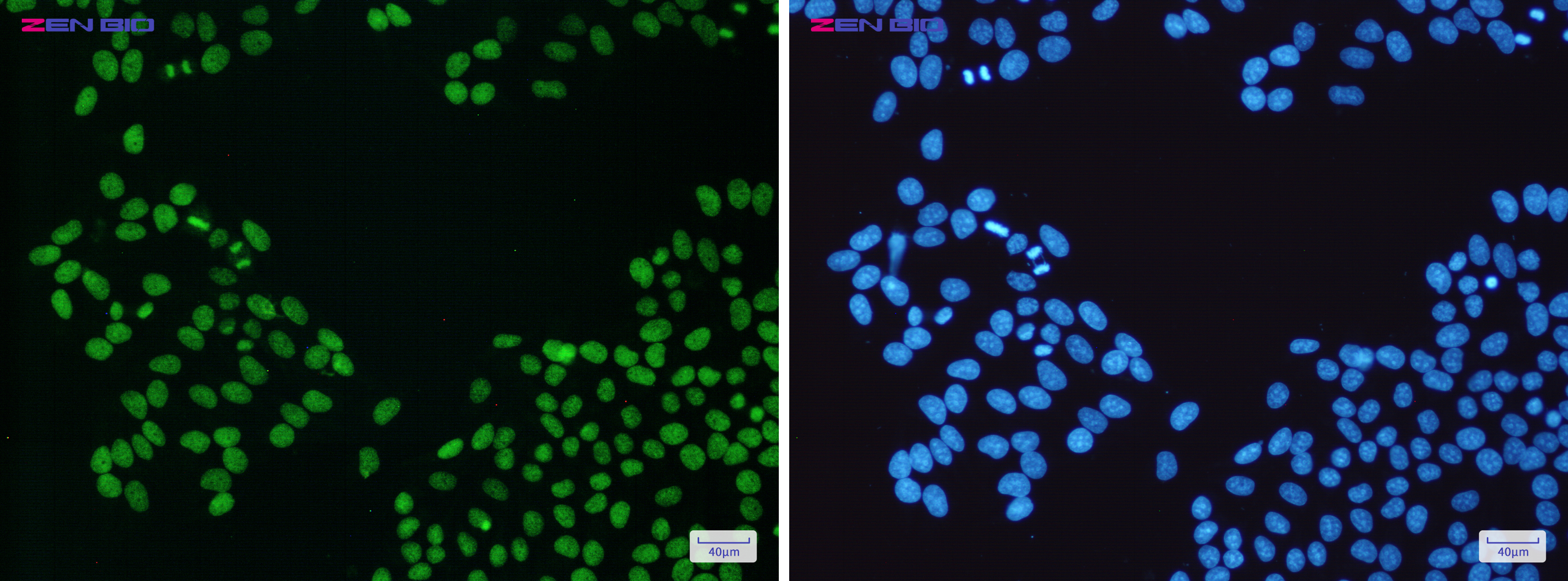 Immunocytochemistry of PARP1(green) in Hela cells using PARP1 Rabbit pAb at dilution 1/50, and DAPI(blue)