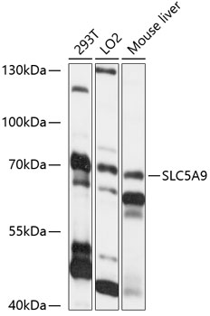 Western blot - SLC5A9 Polyclonal Antibody 