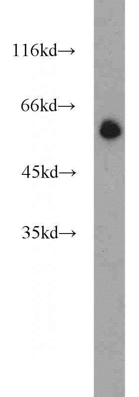 COLO 320 cells were subjected to SDS PAGE followed by western blot with Catalog No:114063(POPDC3 antibody) at dilution of 1:1000