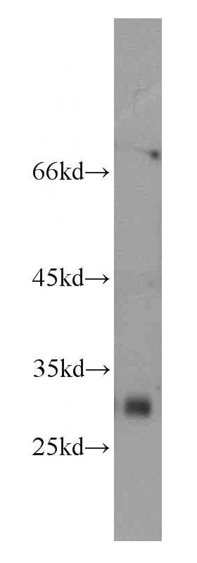 HL-60 cells were subjected to SDS PAGE followed by western blot with Catalog No:112731(MOGAT2 antibody) at dilution of 1:300