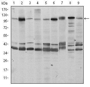 Fig1: Western blot analysis of Fucokinase on different cell lysates using anti- Fucokinase antibody at 1/1,000 dilution.; Positive control:; Lane 1: Hela; Lane 2: HepG2; Lane 3: Jurkat; Lane 4: A431; Lane 5: HEK293; Lane 6: MCF-7; Lane 7: PC-12; Lane 8: Cos7; Lane 9:NIH/3T3
