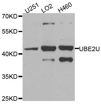 Western blot - UBE2U Polyclonal Antibody 