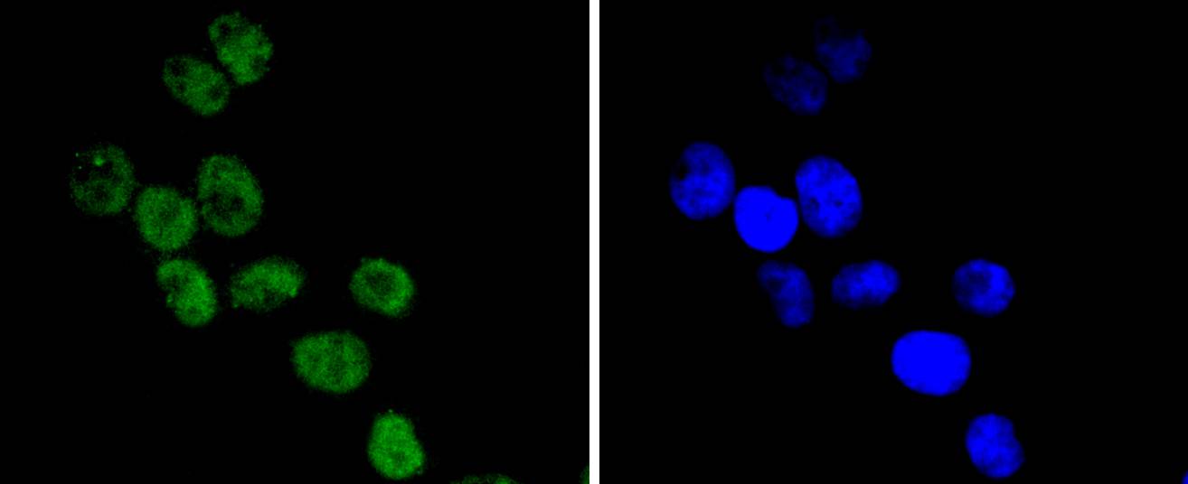 Fig2: ICC staining CDC40 in Hela cells (green). The nuclear counter stain is DAPI (blue). Cells were fixed in paraformaldehyde, permeabilised with 0.25% Triton X100/PBS.