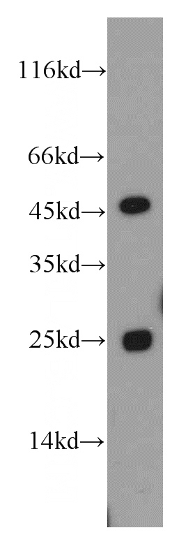mouse liver tissue were subjected to SDS PAGE followed by western blot with Catalog No:109294(CHST13-Specific antibody) at dilution of 1:500