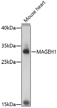 Western blot - MAGEH1 Polyclonal Antibody 