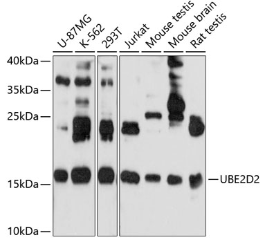 Western blot - UBE2D2 Polyclonal Antibody 