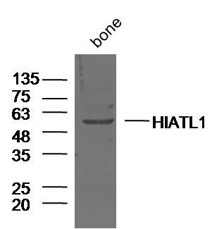 Fig2: Sample:; Bone (Mouse) Lysate at 40 ug; Primary: Anti-HIATL1 at 1/300 dilution; Secondary: IRDye800CW Goat Anti-Rabbit IgG at 1/20000 dilution; Predicted band size: 55 kD; Observed band size: 55 kD