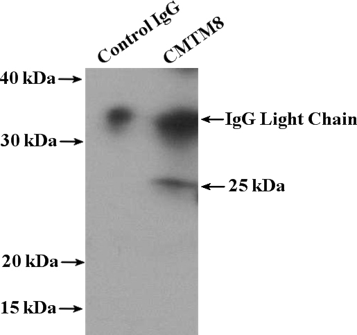 IP Result of anti-CMTM8 (IP:Catalog No:109416, 4ug; Detection:Catalog No:109416 1:300) with mouse liver tissue lysate 6800ug.