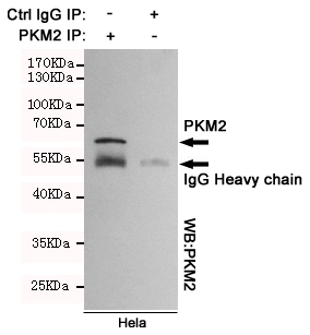 Immunoprecipitation analysis of Hela cell lysates using PKM2.
