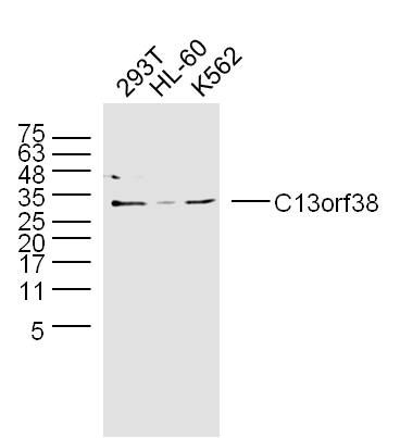 Fig1: Sample:; 293T (Human) Lysate at 40 ug; HL-60 (Human) Lysate at 40 ug; K562 (Human) Lysate at 40 ug; Primary: Anti-C13orf38 at 1/300 dilution; Secondary: IRDye800CW Goat Anti-Rabbit IgG at 1/20000 dilution; Predicted band size: 25 kD; Observed band size: 30 kD