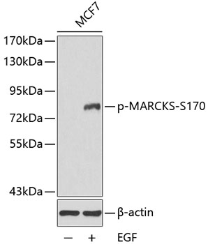 Western blot - Phospho-MARCKS-S170 pAb 